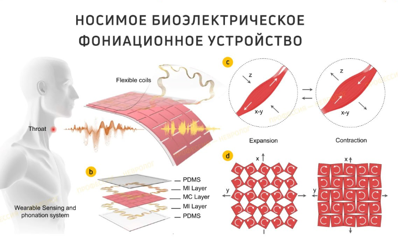 16.05.24 Аппарат, возвращающий речь новая разработка ученых.png