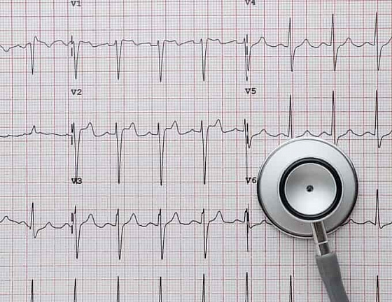 Нейросеть научили распознавать следы сердечно-сосудистых заболеваний по ЭКГ