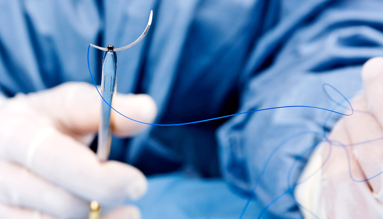 Новые разработки быстродействующего анестетика и совершенствование хирургии