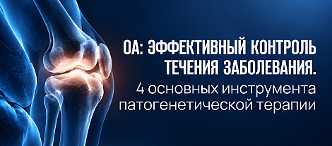 ОА: эффективный контроль течения заболевания. 4 основных инструмента патогенетической терапии
