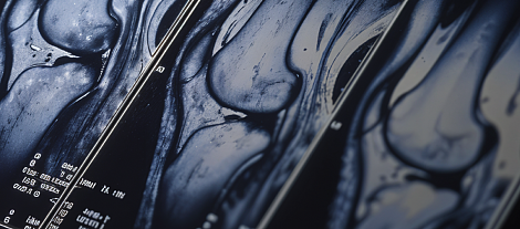 Современная терапия подагры и остеоартрита: что нового для практикующего специалиста