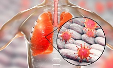 Обновлены клинические рекомендации по лечению вирусных пневмоний