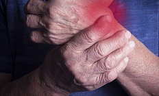 Исследование подтвердило связь между обострениями артрита и пародонтитом